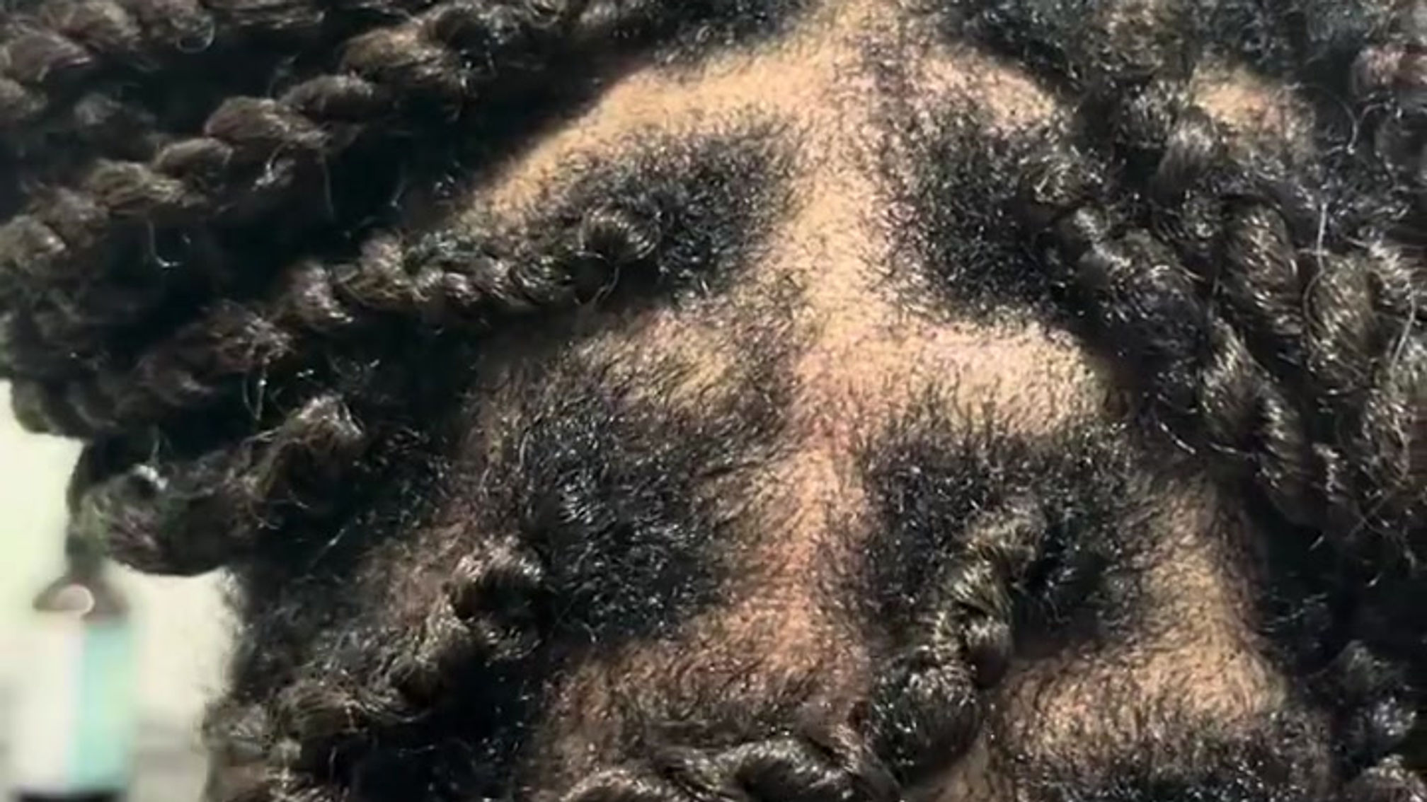 Healthy Scalp
